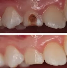 Бештоева Арина Мусарбиевна