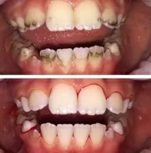 Бештоева Арина Мусарбиевна