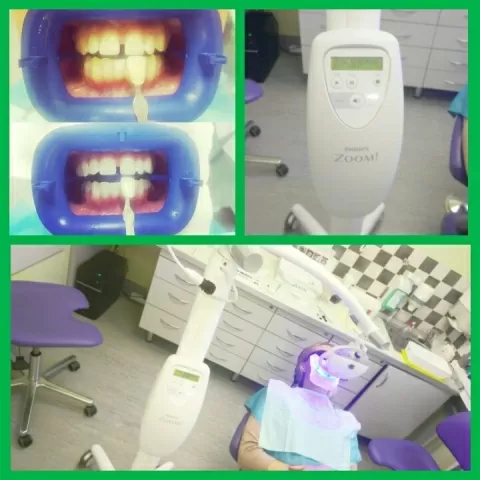 Стоматологическая клиника 33-й Зуб