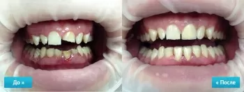 Крепкий Орешек