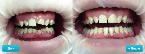 Крепкий Орешек