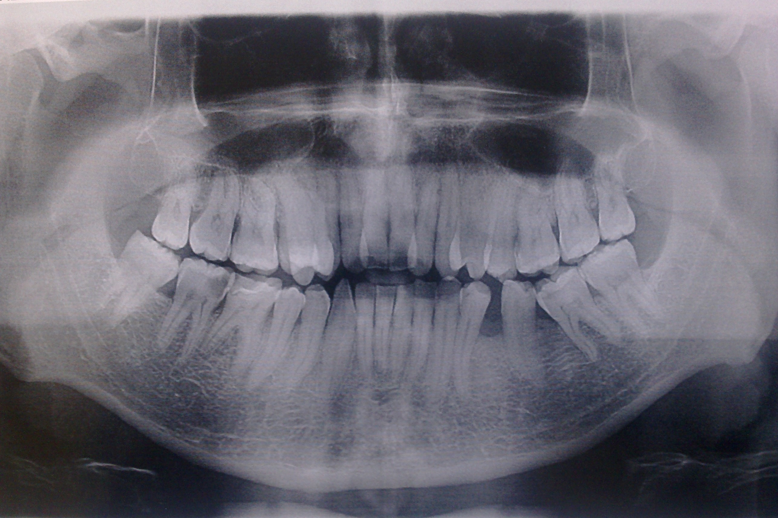 Зубы внутри рта. Фотография изнутри рта.