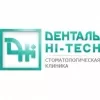 Денталь Hi-Tech