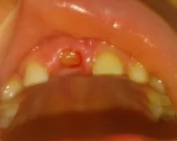 Сонник: к чему снятся выпавшие зубы