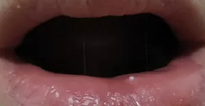 Посинение губ