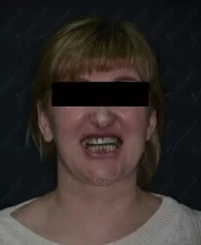 #alt#