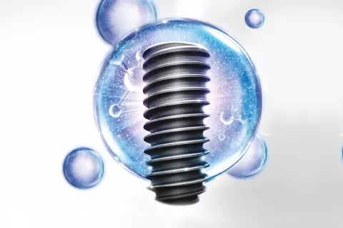 Установка импланта под ключ OSSTEM