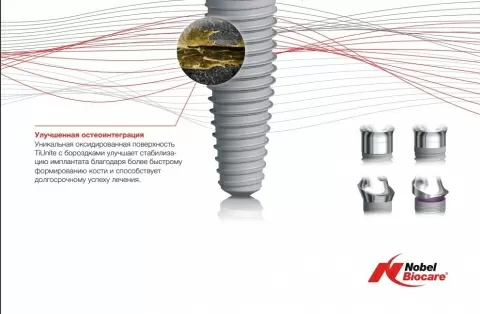Имплант Nobel + коронка под ключ!