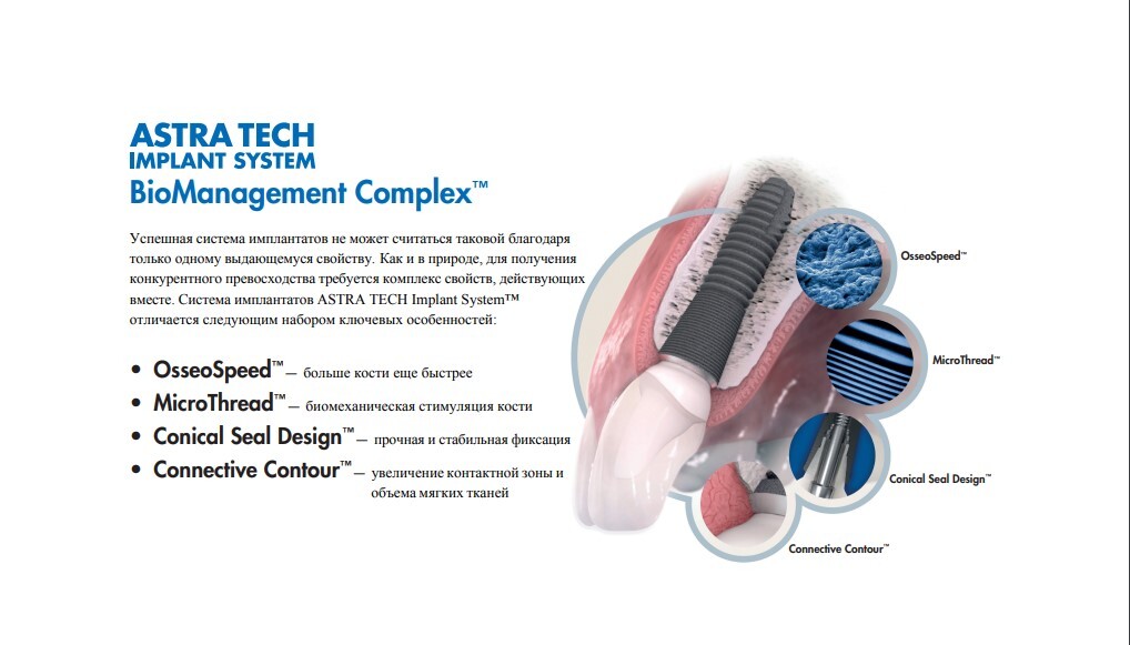 Имплант Astra Tech + циркониевая коронка