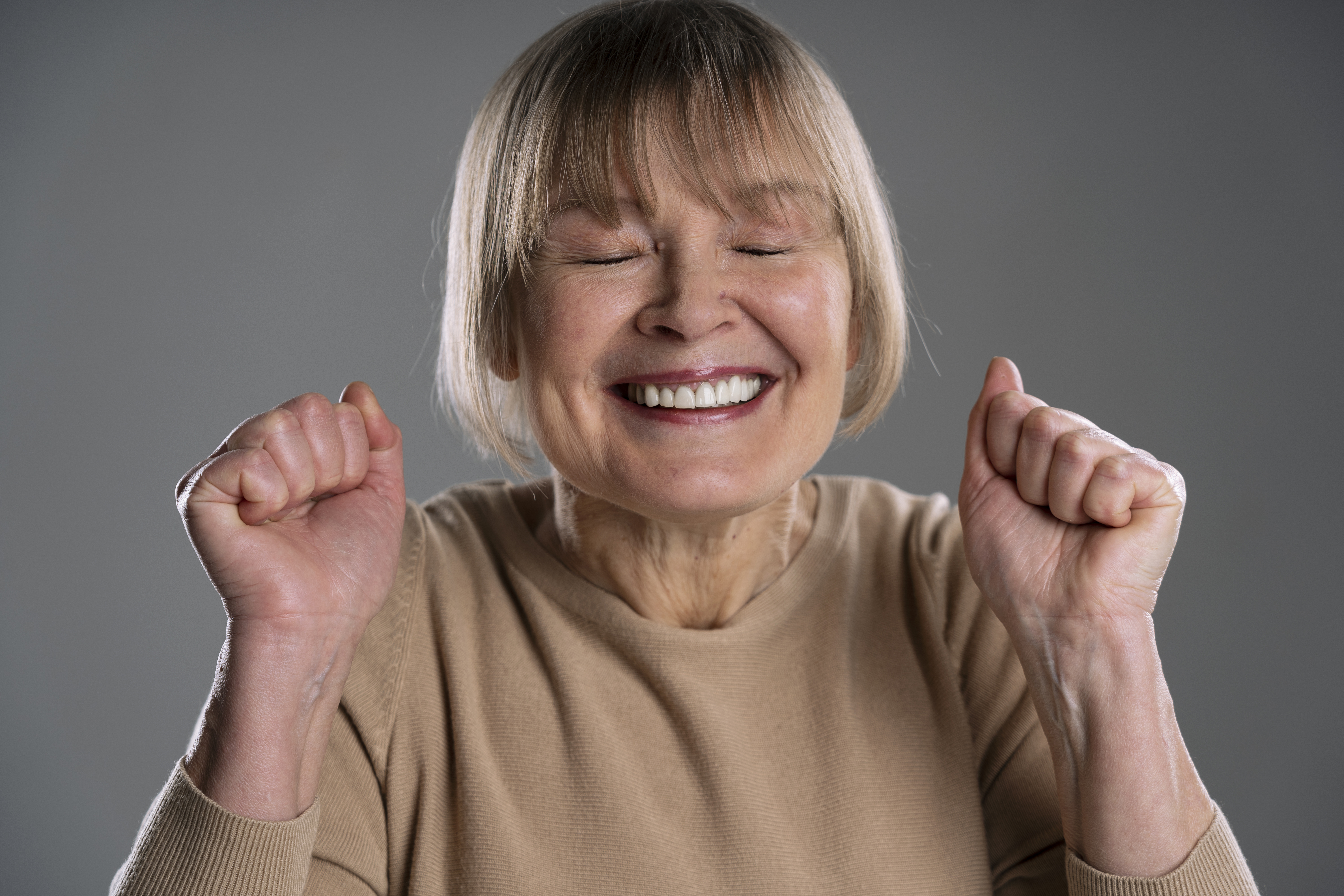 Протезирование всех зубов на 4 имплантах
