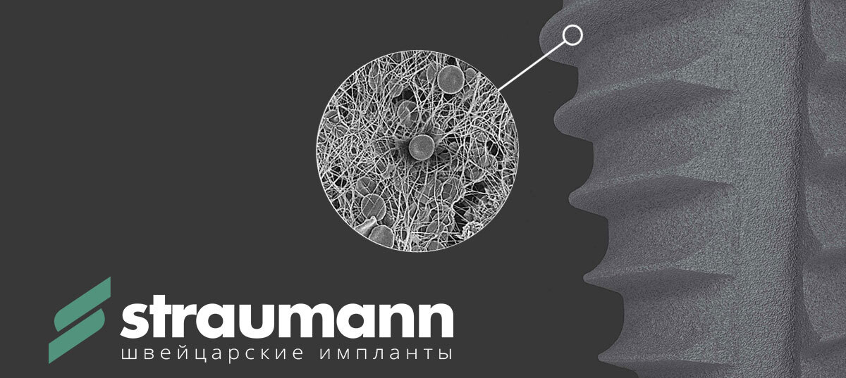 Имплантация зубов Straumann + коронка