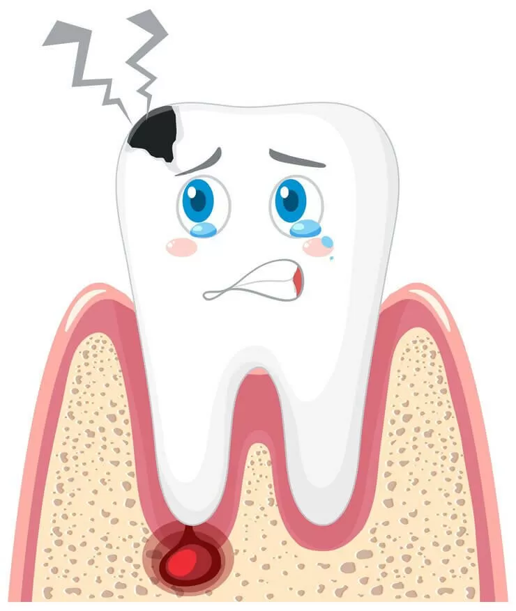 Народные средства от зубной боли 🦷 Лучшие способы избавиться от зубной боли ☘️ | CIS