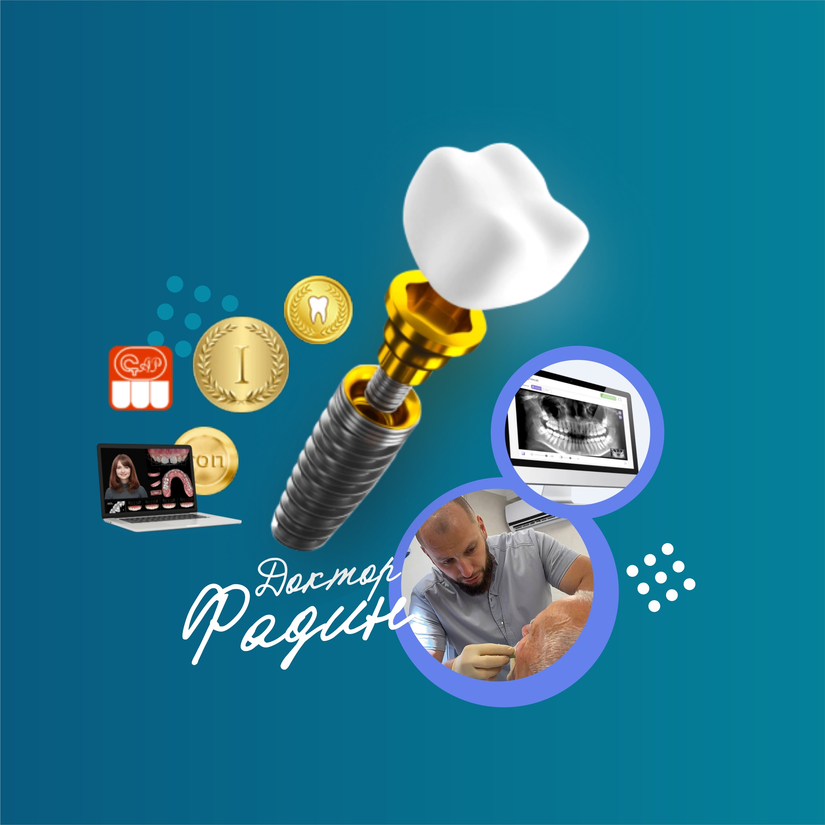 Имплантация «под ключ» Alpha Bio за 28 900 рублей!