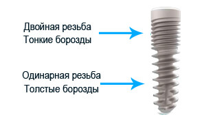 Ards имплантат серии Смарт Система Ards